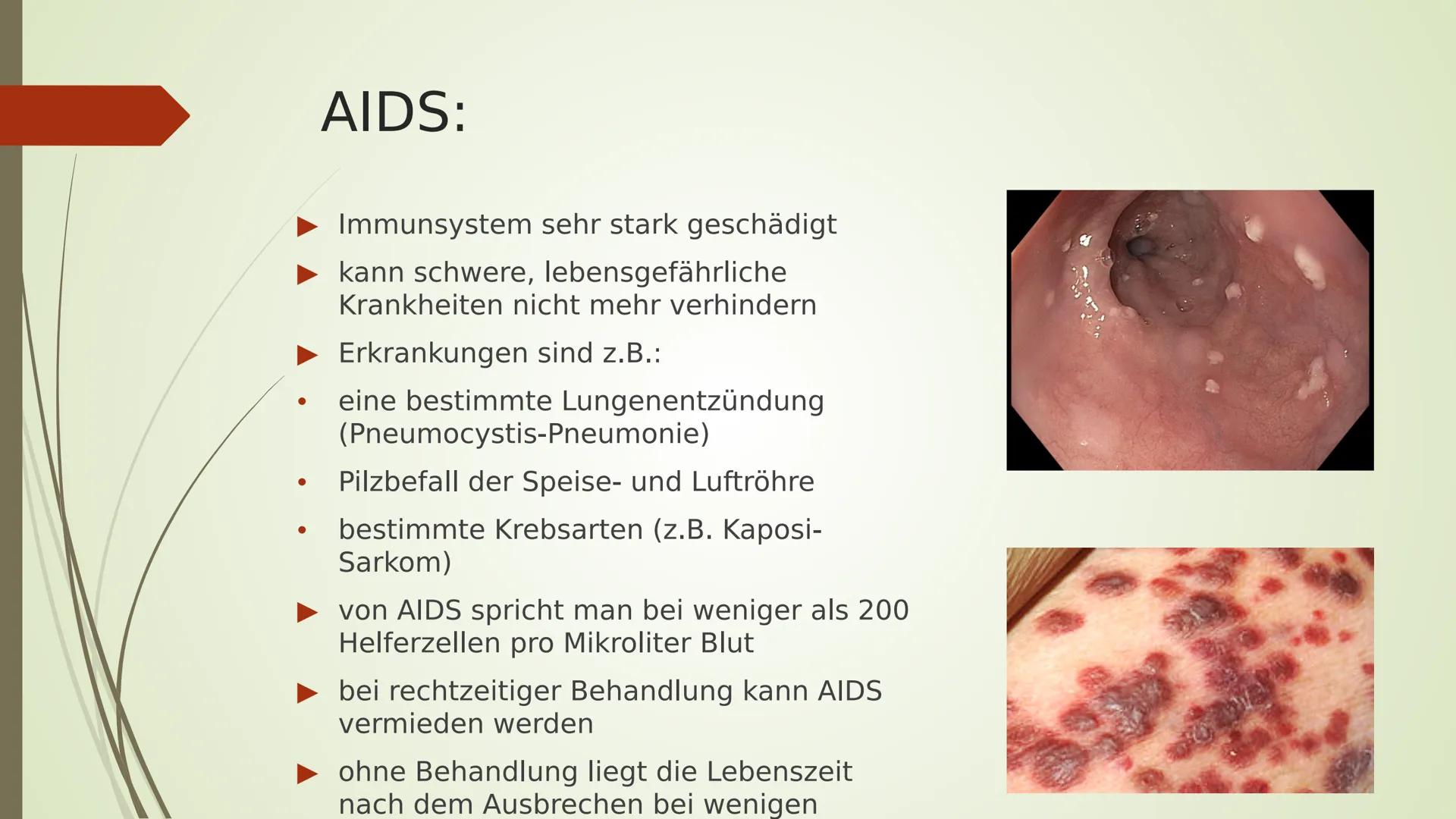 AIDS
HIV
YRITY Gliederung:
■ Arten
■
■
■
Allgemeines
Das HI-Virus
■
■ Geschichtliches
Übertragung
■ Ablauf/ Symptome
■
Aufbau
Woher kommt er