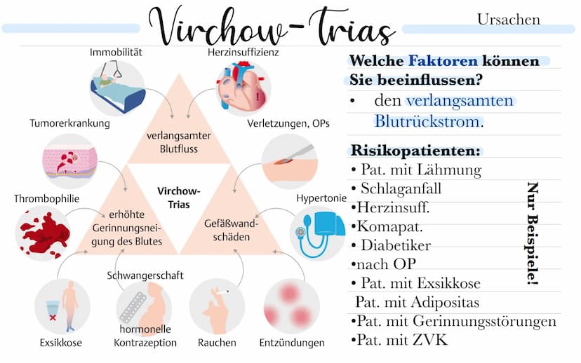 thromboseprophylaxe
Musste wissen:
Was ist ein Thrombus? - Blutpfropf, - gerinnsel, Koagel
Was ist Thrombose? - Teilweise o. vollständiger V