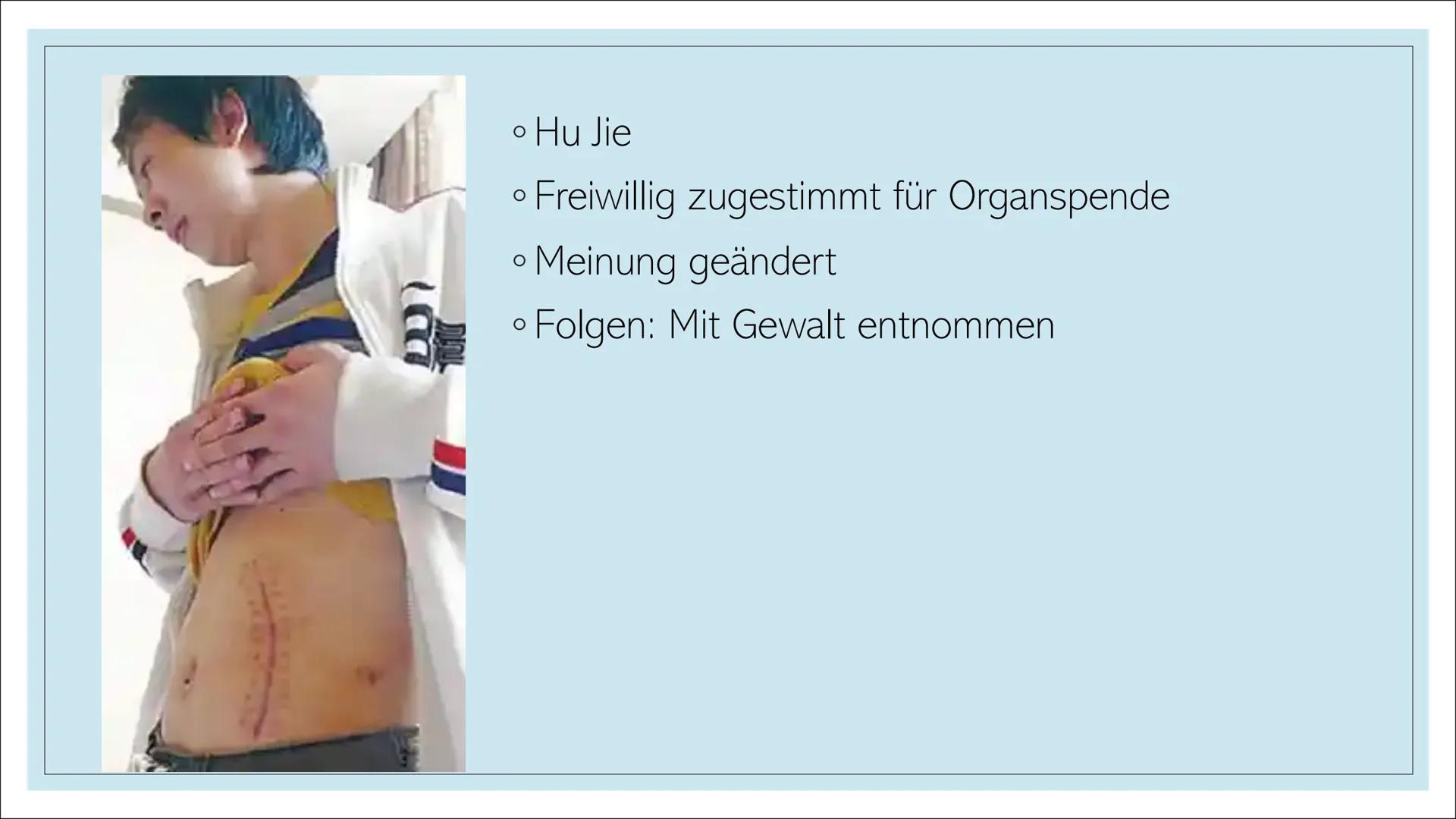 ORGANSPENDE Struktur
1. Leitfrage
2.
Definition
3. Organe und Gewebe zum Spenden
4. Voraussetzungen
5. Organspendeausweis
6. Organspender in