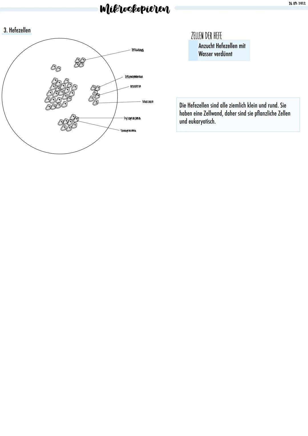 1.Zwiebelzellen
Vakuole
2. Munschleimhautzellen
Zell membran
Mikroskopieren
Cytoplasma
Zellwand
-Tonoplasma
-Zellkern
Zellkern mit
Kernmembr