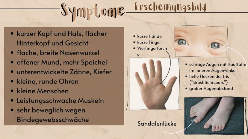 O
Down-Syndrom
eine Erbkrankheit?
Präsentation
Sarah Keller
13.01.2021
BIO LK
HB Gliederung E
Was ist ein Syndrom?
Down-Syndrom-Ein Syndrom?