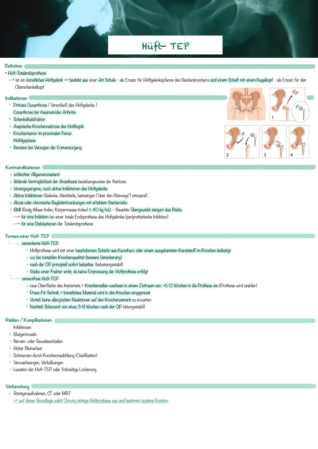 Definition
= Hüft-Totalendoprothese
-> ist ein künstliches Hüftgelenk => besteht aus einer Art Schale- als Ersatz für Hüftgelenkspfanne des 