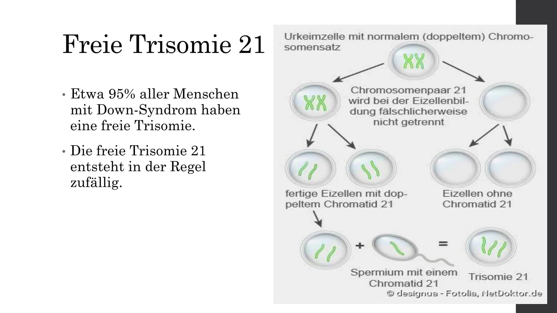 Trisomie 21
Von Elisabeth A. Inhaltsverzeichnis
Was ist Trisomie 21?
Die Formen der Trisomie 21
. Die Geschichte des Down-Syndroms
●
●
Die v