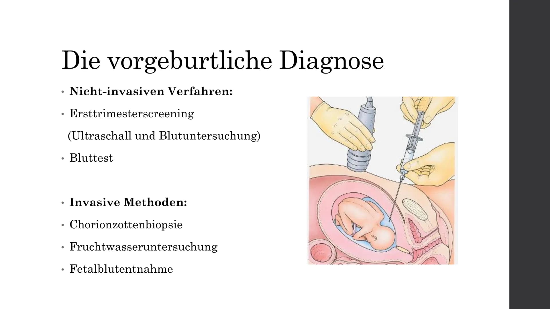 Trisomie 21
Von Elisabeth A. Inhaltsverzeichnis
Was ist Trisomie 21?
Die Formen der Trisomie 21
. Die Geschichte des Down-Syndroms
●
●
Die v
