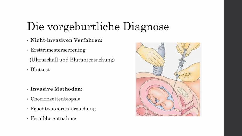 Trisomie 21
Von Elisabeth A. Inhaltsverzeichnis
Was ist Trisomie 21?
Die Formen der Trisomie 21
. Die Geschichte des Down-Syndroms
●
●
Die v