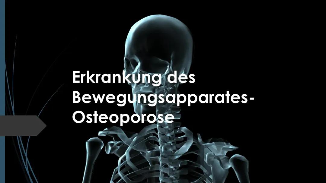 Osteoporose