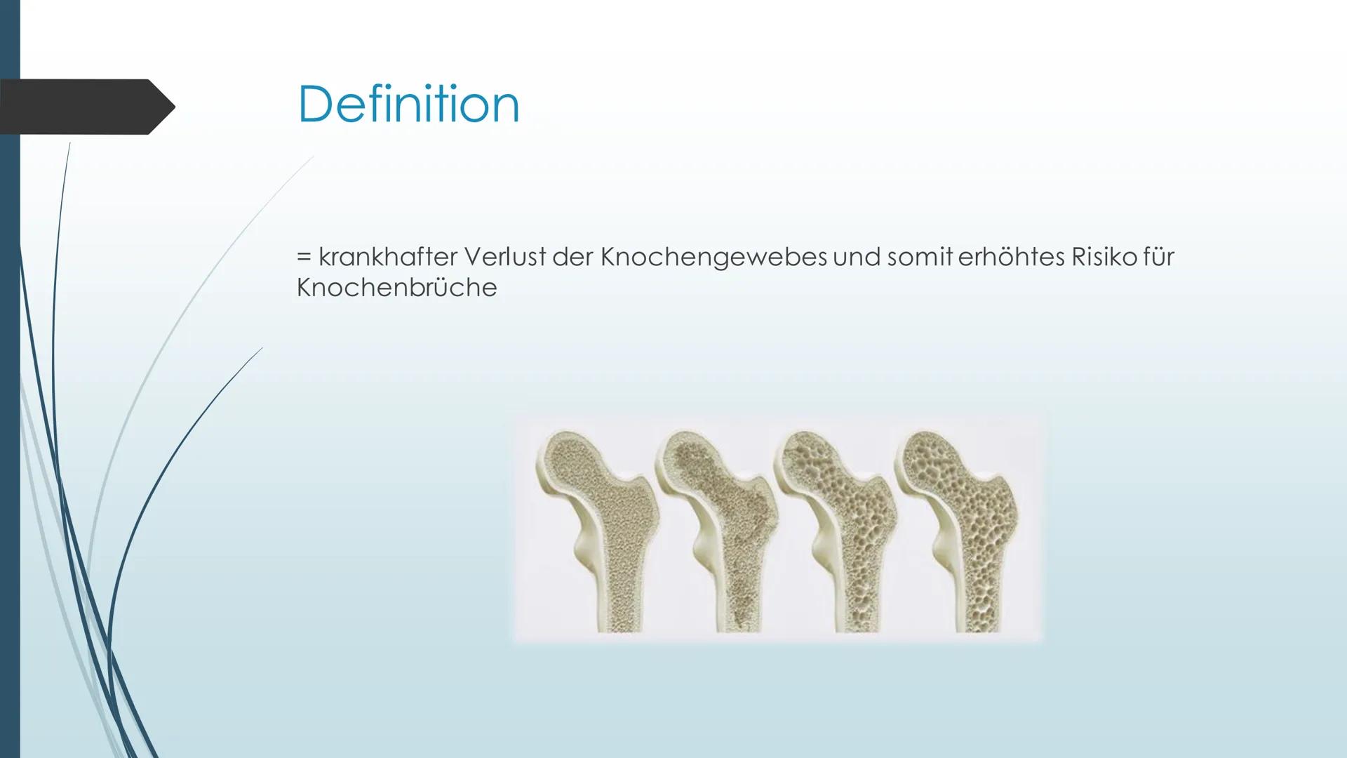 Erkrankung des
Bewegungsapparates-
Osteoporose Inhalt
●
●
●
●
●
●
●
Definition
Ursache
Symptome
Risikofaktoren
Diagnose
Therapie
Anwendungsb