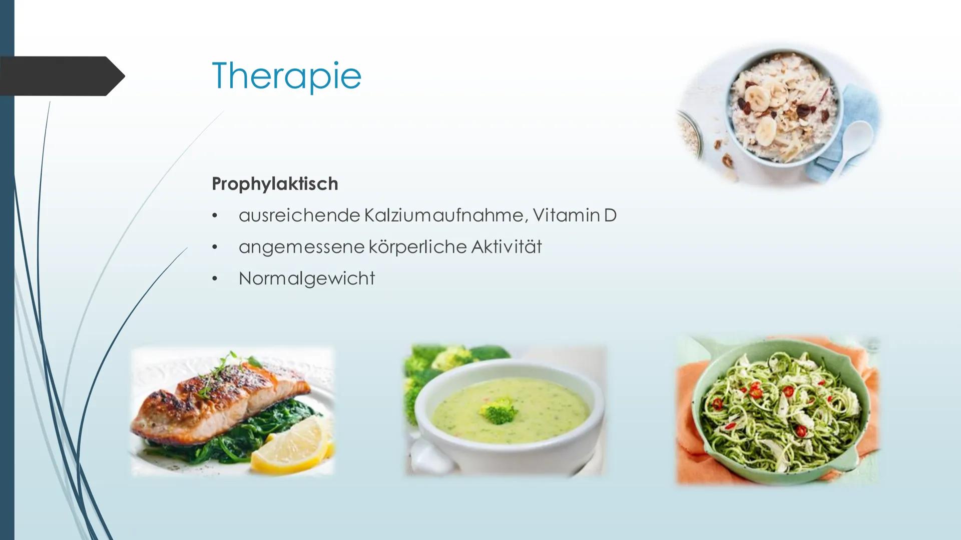 Erkrankung des
Bewegungsapparates-
Osteoporose Inhalt
●
●
●
●
●
●
●
Definition
Ursache
Symptome
Risikofaktoren
Diagnose
Therapie
Anwendungsb