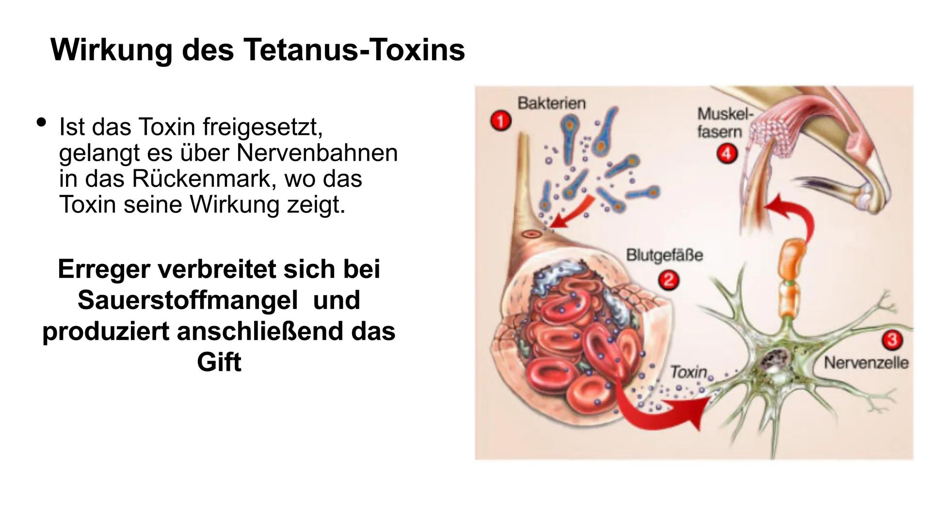 Tetanus
Wundstarrkampf
Amelie und Tasnim
JC
wiki How Erreger, Art des Erregers
• Übertragungswege/Ansteckung
●
●
●
Wirkung des Tetanus-Toxin