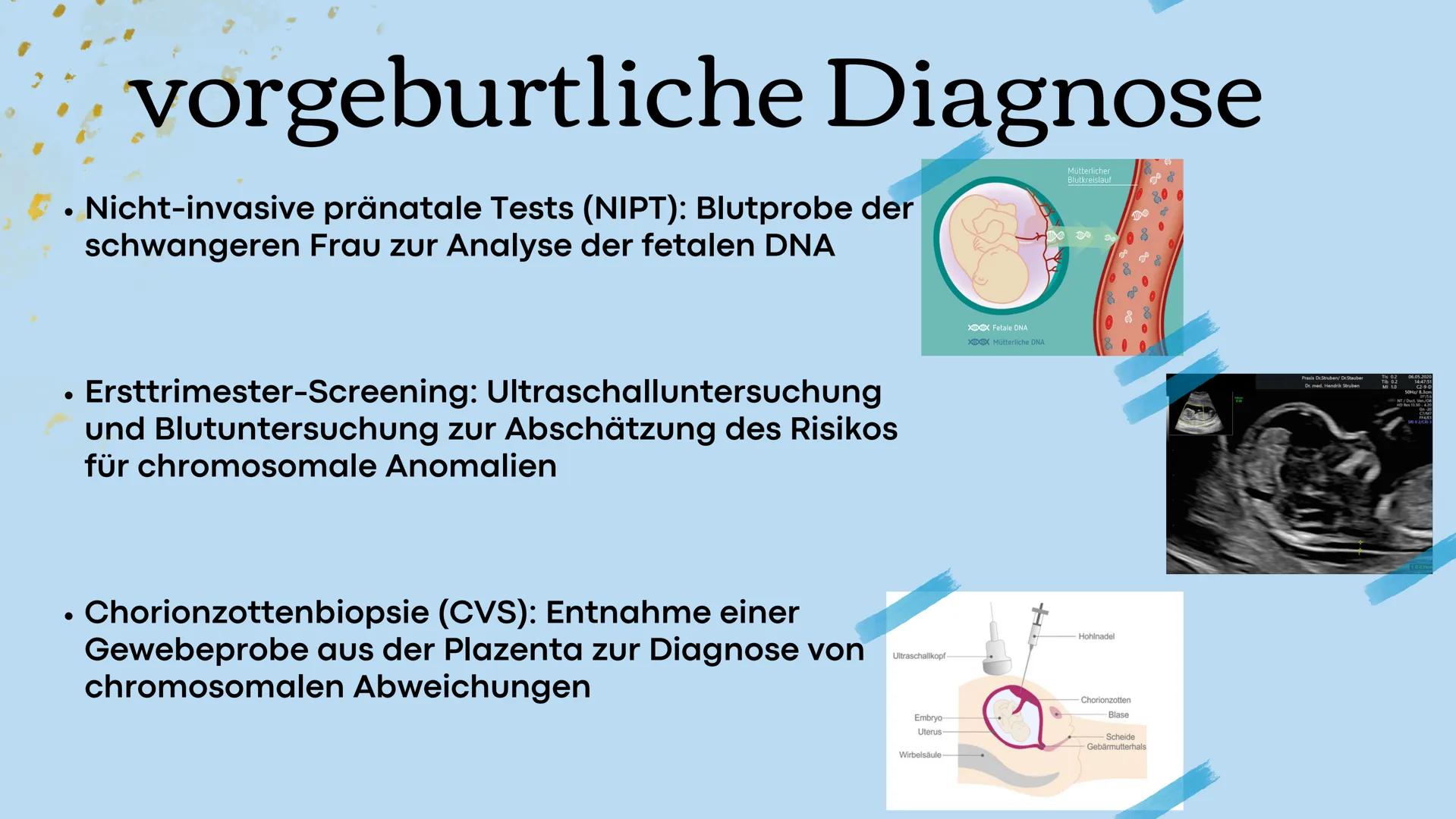 # Trisomie 21

Präsentation zum Thema Down-
Syndrom # Gliederung

1. Beschreibung Trisomie 21
2. Genetische Ursachen
3. Risikofaktoren
4. vo