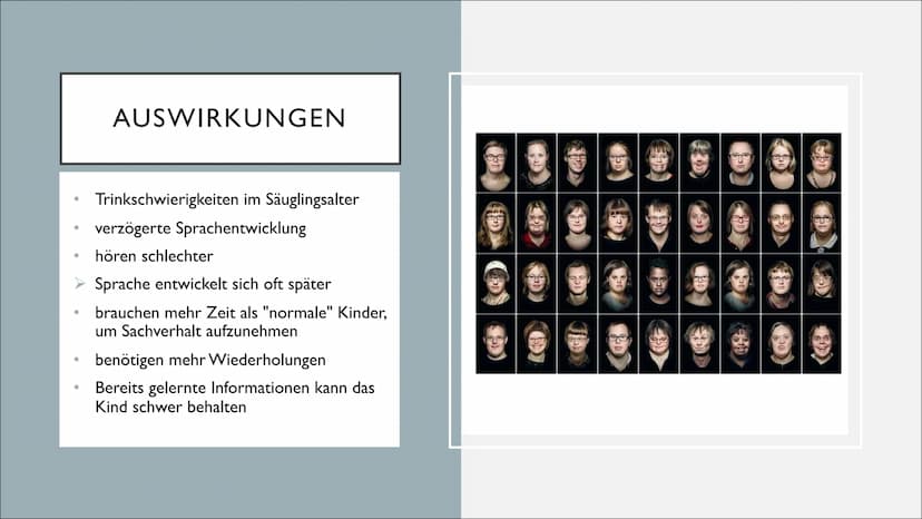 TRISOMIE 21
Victoria Römisch-27.04.21
QII-Bio-Sandt I. Grundlegendes
o Downsyndrom
o Symptomatik
o Auswirkungen
2. Genetik
o Das dritte Chro