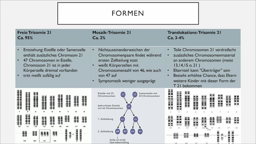 TRISOMIE 21
Victoria Römisch-27.04.21
QII-Bio-Sandt I. Grundlegendes
o Downsyndrom
o Symptomatik
o Auswirkungen
2. Genetik
o Das dritte Chro