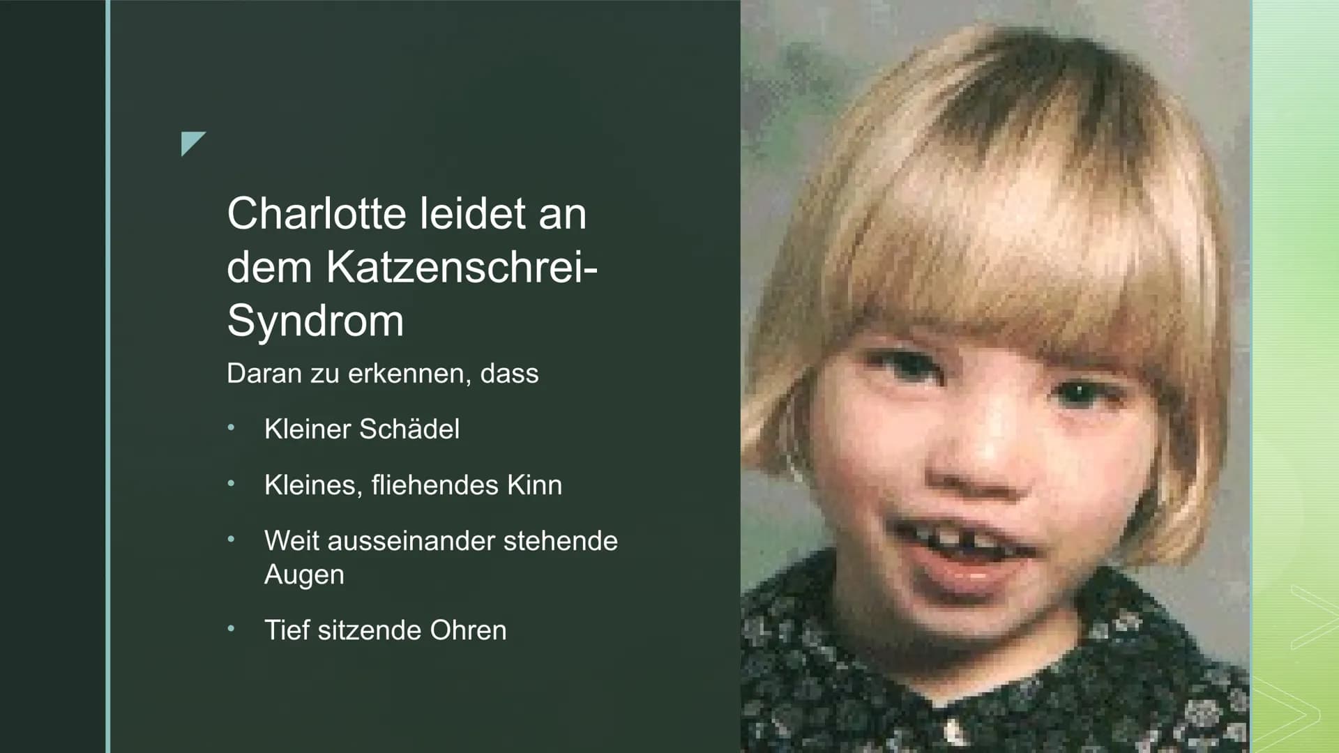 DAS CRI-DU-CHAT-SYNDROM
Folie 1: Das Cri-du-chat-Syndrom, auch Katzenschrei-Syndrom oder p5-minus-
Syndrom genannt, ist eine in Europa zwar 