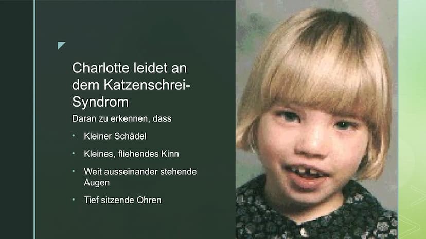 DAS CRI-DU-CHAT-SYNDROM
Folie 1: Das Cri-du-chat-Syndrom, auch Katzenschrei-Syndrom oder p5-minus-
Syndrom genannt, ist eine in Europa zwar 