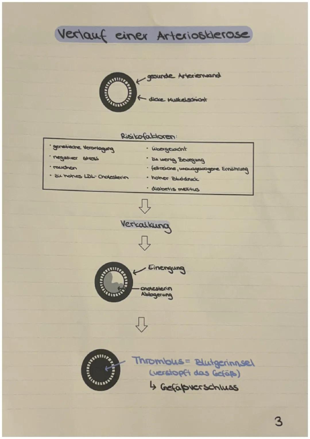 Symtome

Zienender Schmerz in den
Beinen, schwindel, Gedächtnis-
Störungen, Angeschlagenheit,
Hüdigkeit, Armer Beine adhlafen
oft ein, schme