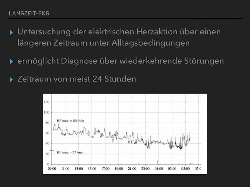 EEG-1
EEG-2
EEG-3
EKG
BIOLOGIE
EKG & EEG
مسد
What
[5μV] EKG (Elektrokardiogramm):
= Aufzeichnung von elektrischen Spannungen bei jedem Herzs