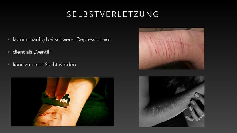 VON LENA A. UND LILLIANA G.
DEPRESSION DEFINITIONEN WICHTIGER BEGRIFFE
• affektive Störung: emotionale Störung, beschreibt übermäßige Trauer