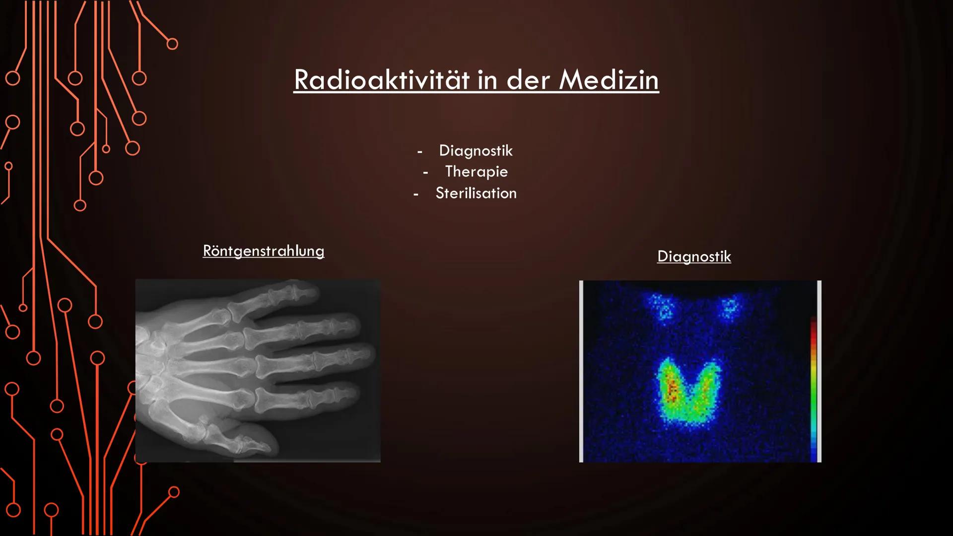 Radioaktivität in der Medizin
Röntgenstrahlung
Diagnostik
Therapie
Sterilisation
Diagnostik Allgemeine Informationen:
●
Oft bei der Schilddr