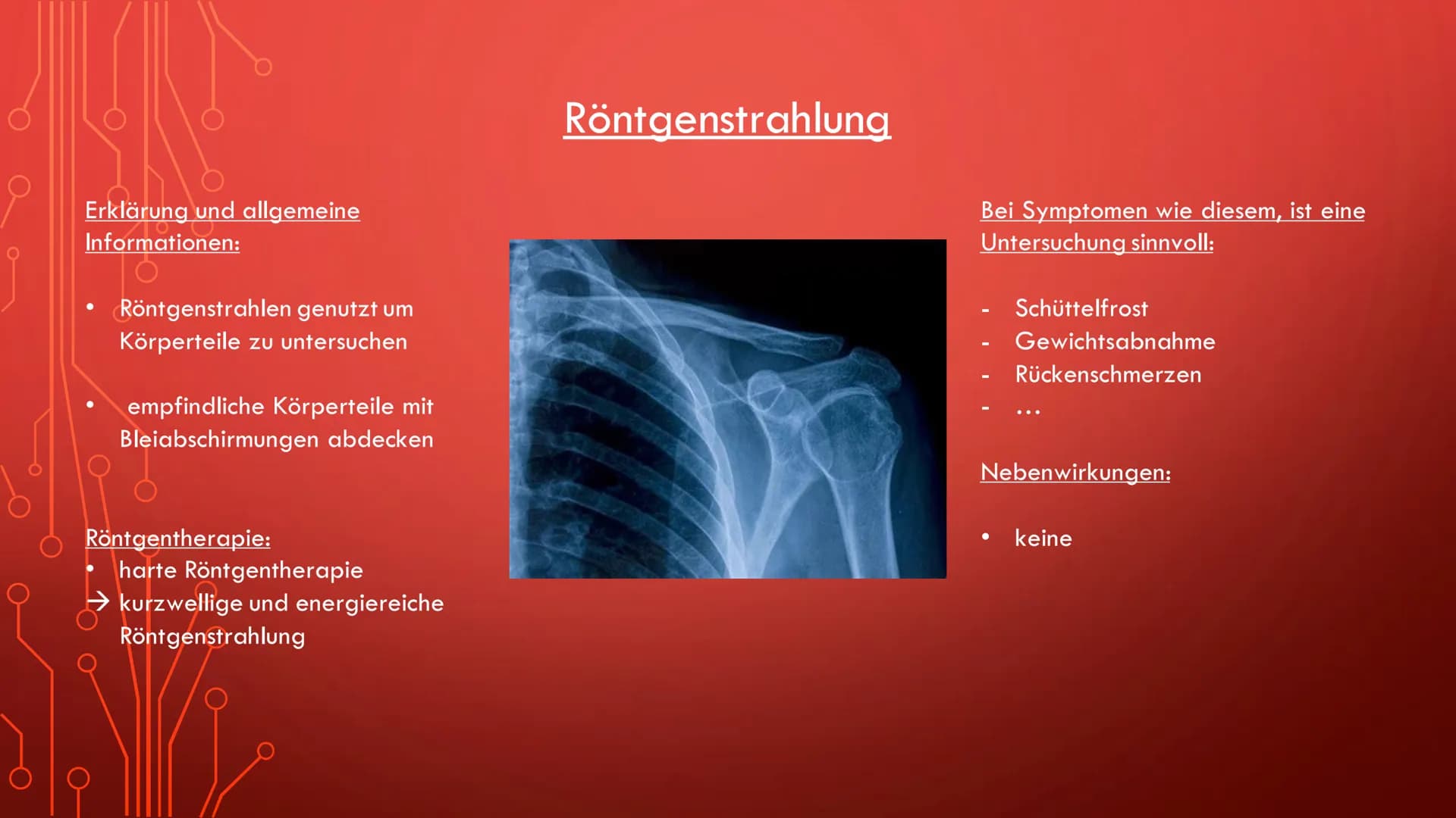 Radioaktivität in der Medizin
Röntgenstrahlung
Diagnostik
Therapie
Sterilisation
Diagnostik Allgemeine Informationen:
●
Oft bei der Schilddr