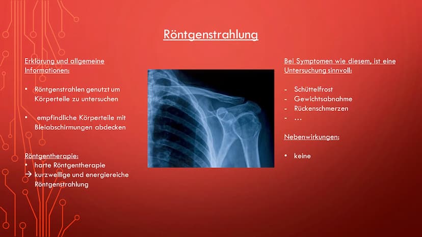 Radioaktivität in der Medizin
Röntgenstrahlung
Diagnostik
Therapie
Sterilisation
Diagnostik Allgemeine Informationen:
●
Oft bei der Schilddr