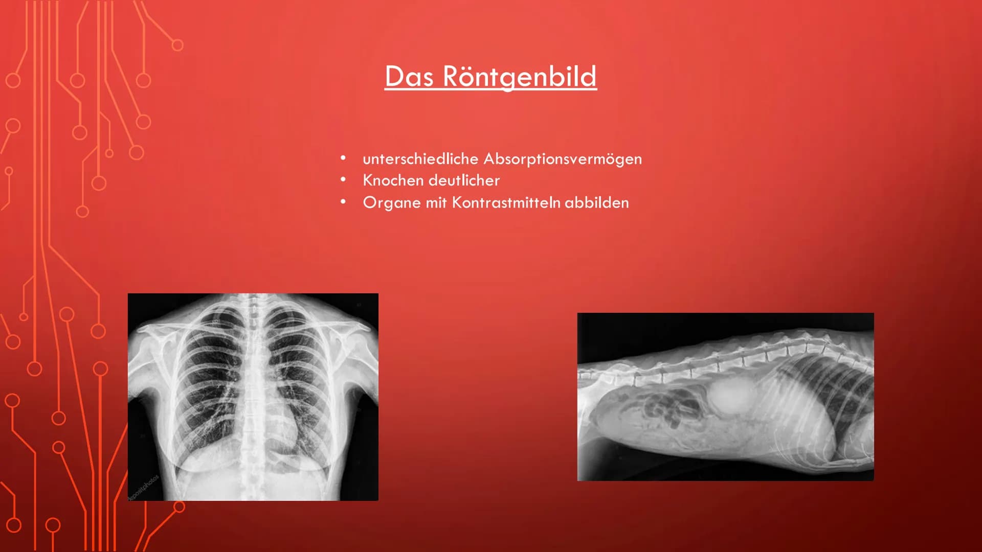 Radioaktivität in der Medizin
Röntgenstrahlung
Diagnostik
Therapie
Sterilisation
Diagnostik Allgemeine Informationen:
●
Oft bei der Schilddr