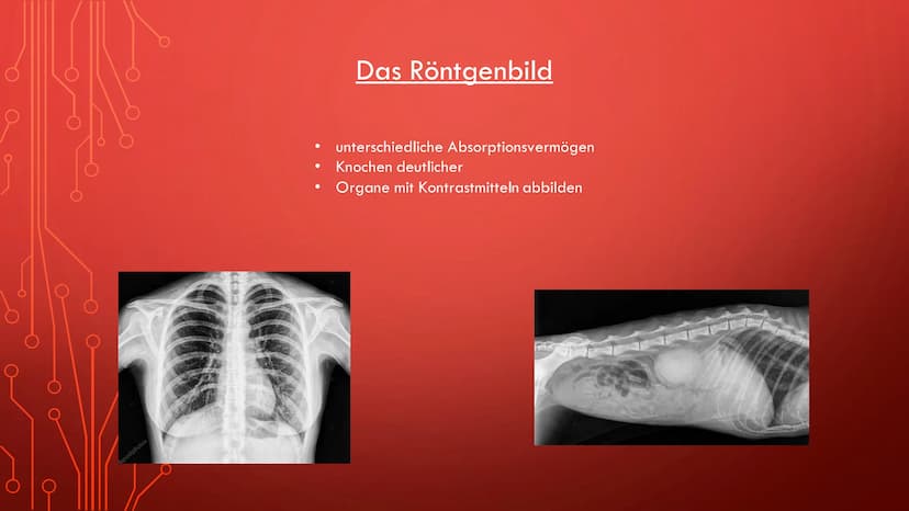Radioaktivität in der Medizin
Röntgenstrahlung
Diagnostik
Therapie
Sterilisation
Diagnostik Allgemeine Informationen:
●
Oft bei der Schilddr