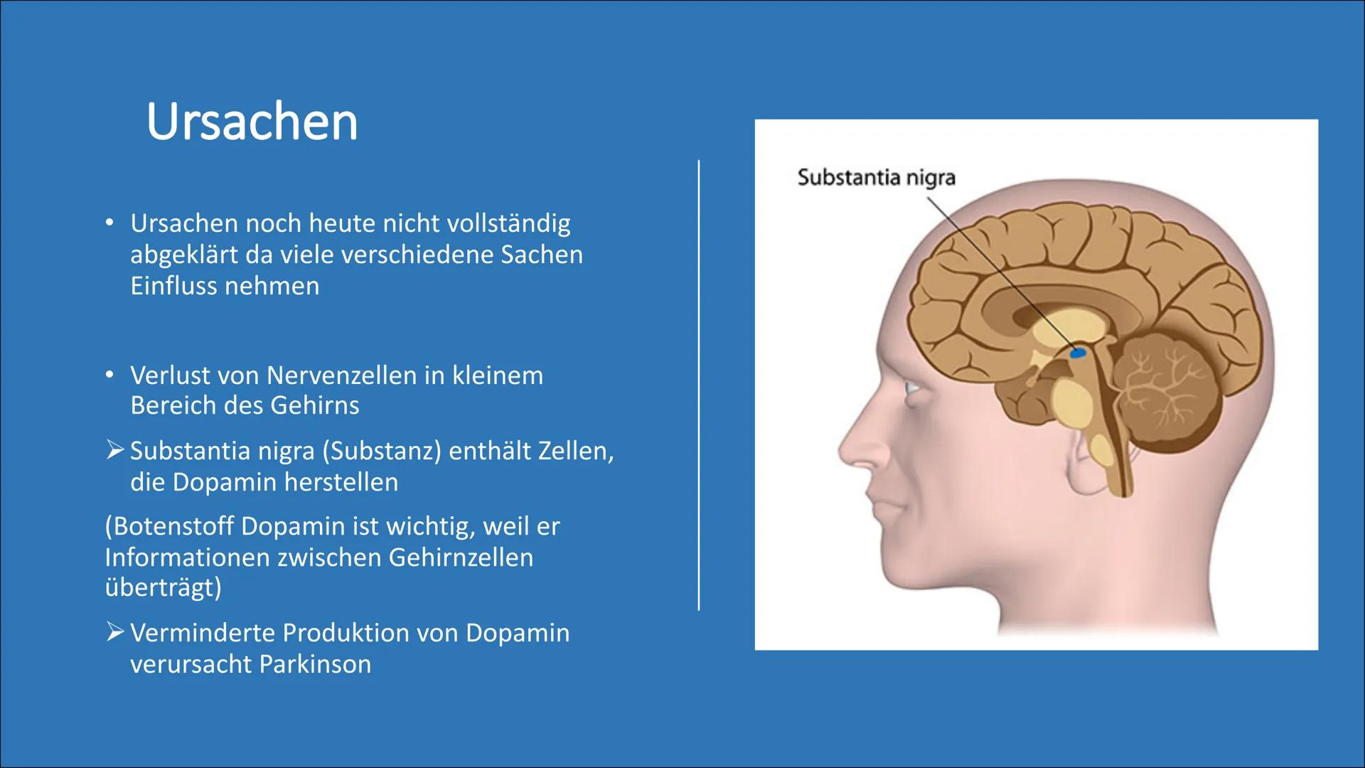 Morbus Parkinson
(Schüttellähmung) Themen
• Was ist Parkinson?
Wissenswertes
●
Normales Gehin vs. Parkinson betroffenes Gehirn
Ursachen
• Sy
