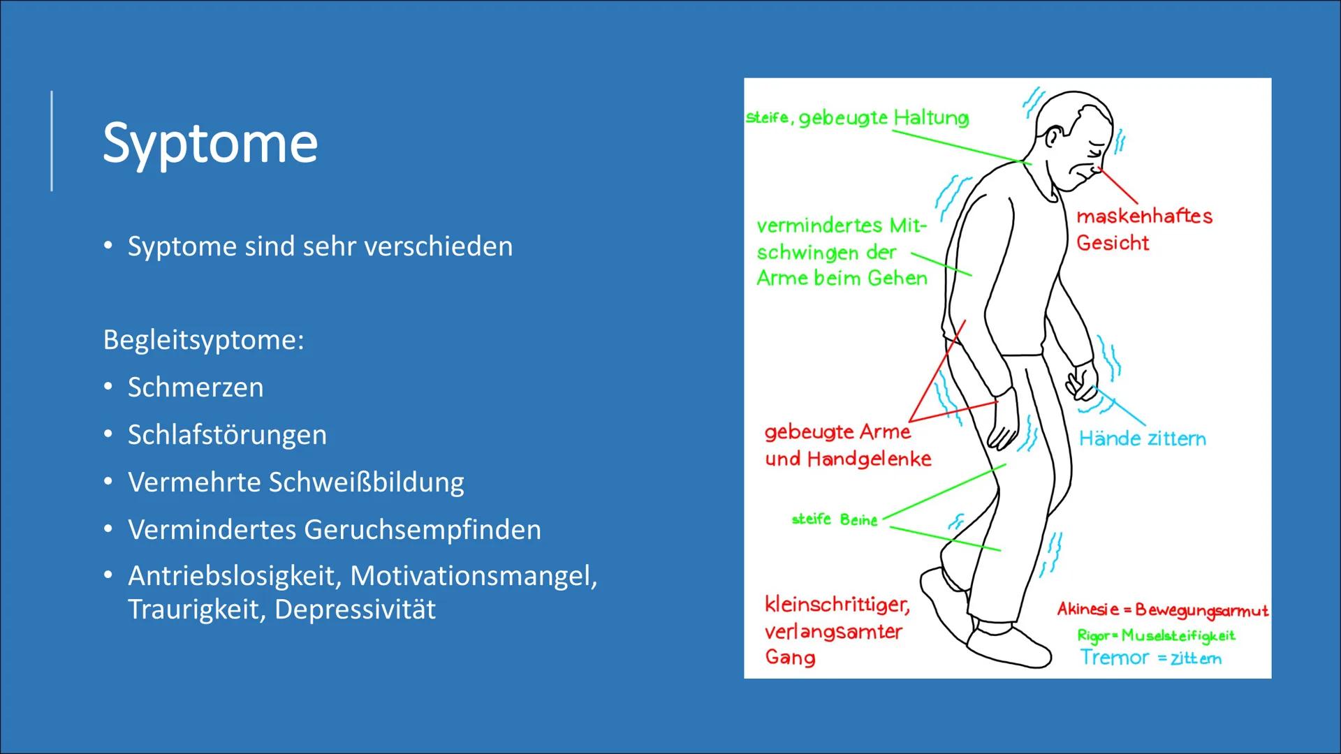 Morbus Parkinson
(Schüttellähmung) Themen
• Was ist Parkinson?
Wissenswertes
●
Normales Gehin vs. Parkinson betroffenes Gehirn
Ursachen
• Sy