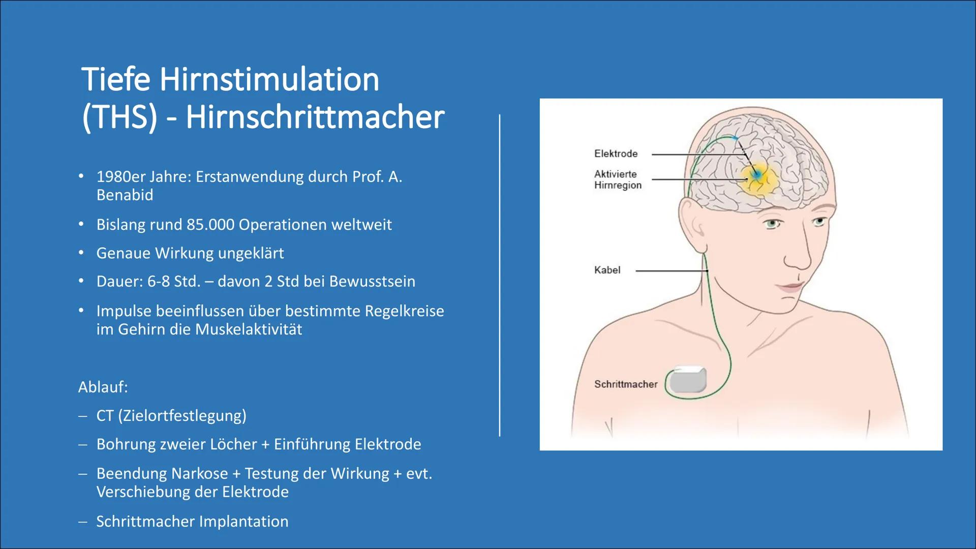 Morbus Parkinson
(Schüttellähmung) Themen
• Was ist Parkinson?
Wissenswertes
●
Normales Gehin vs. Parkinson betroffenes Gehirn
Ursachen
• Sy
