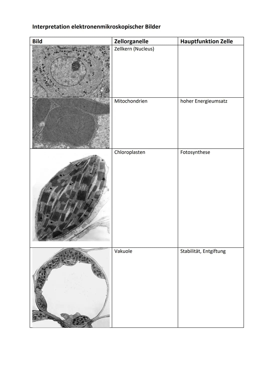 Interpretation elektronenmikroskopischer Bilder
Bild
Zellorganelle
Zellkern (Nucleus)
Mitochondrien
Chloroplasten
Vakuole
Hauptfunktion Zell