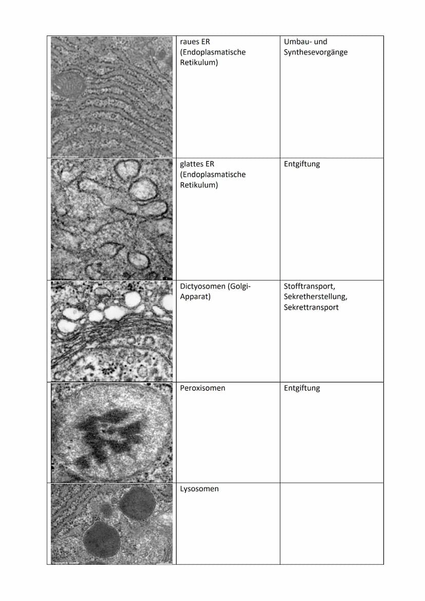Interpretation elektronenmikroskopischer Bilder
Bild
Zellorganelle
Zellkern (Nucleus)
Mitochondrien
Chloroplasten
Vakuole
Hauptfunktion Zell