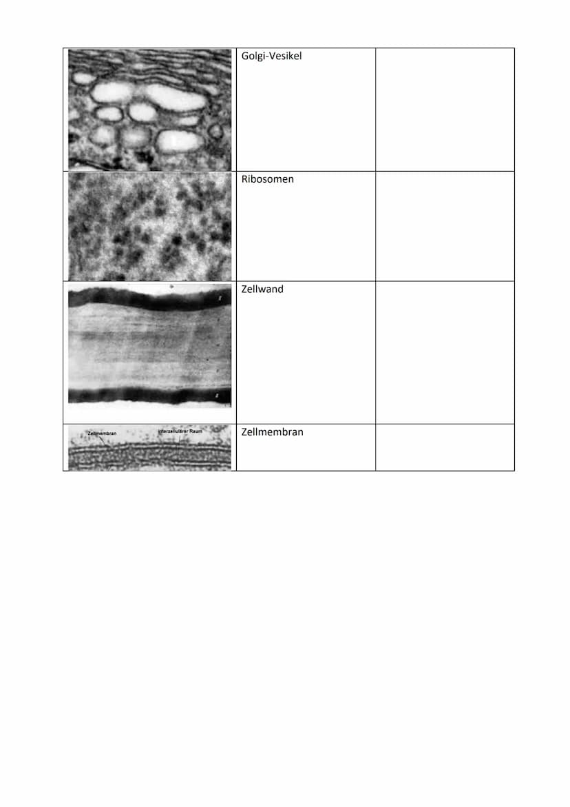 Interpretation elektronenmikroskopischer Bilder
Bild
Zellorganelle
Zellkern (Nucleus)
Mitochondrien
Chloroplasten
Vakuole
Hauptfunktion Zell