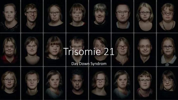 Know Trisomie 21 ( Das Down Syndrom )  thumbnail