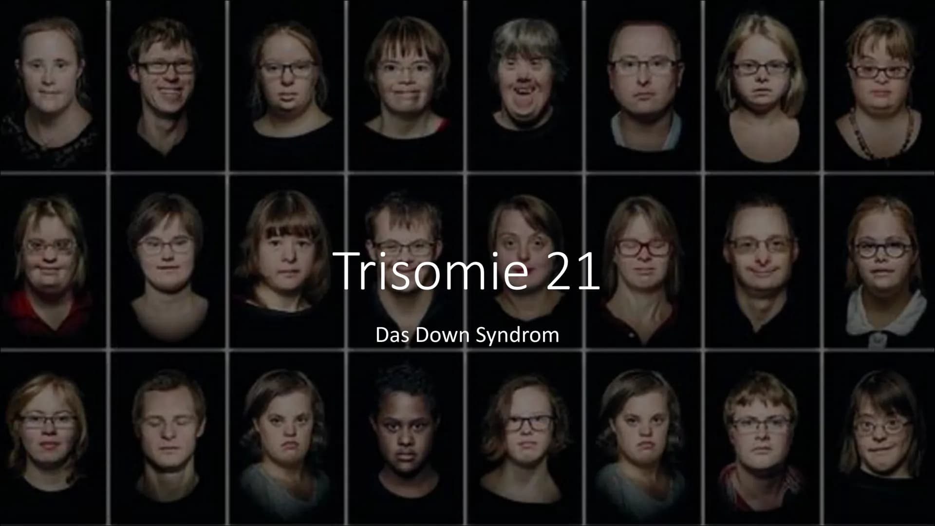 Trisomie 21
Das Down Syndrom Gliederung
●
●
●
●
Allgemeine Informationen
Krankheitsbild
Entdeckung - Geschichte
Entstehung - Ursachen - Risi