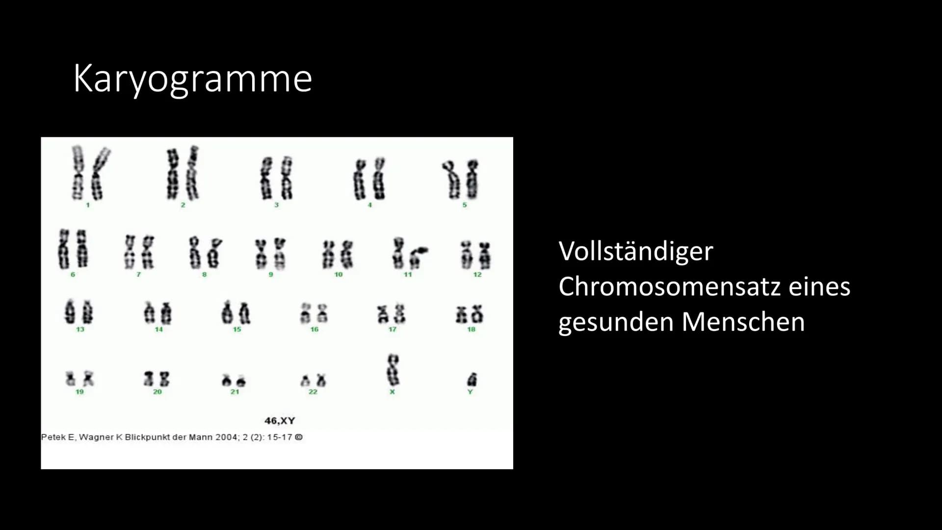 Trisomie 21
Das Down Syndrom Gliederung
●
●
●
●
Allgemeine Informationen
Krankheitsbild
Entdeckung - Geschichte
Entstehung - Ursachen - Risi