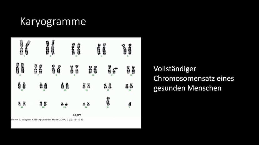 Trisomie 21
Das Down Syndrom Gliederung
●
●
●
●
Allgemeine Informationen
Krankheitsbild
Entdeckung - Geschichte
Entstehung - Ursachen - Risi