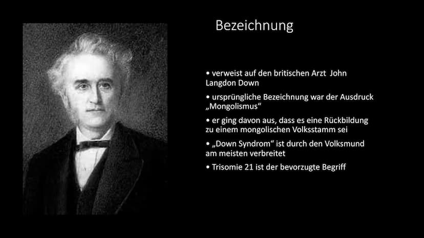 Trisomie 21
Das Down Syndrom Gliederung
●
●
●
●
Allgemeine Informationen
Krankheitsbild
Entdeckung - Geschichte
Entstehung - Ursachen - Risi