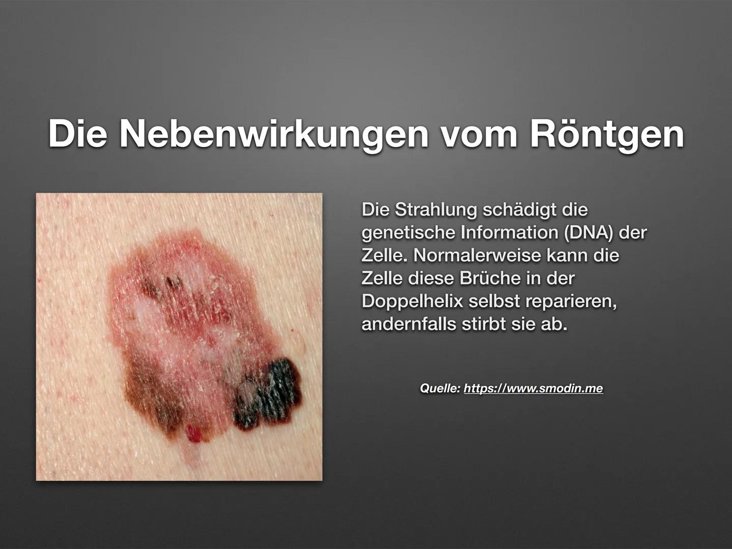 Radioaktivität in der Medizin
Melisa Yedekcioglu ●
• Was sind Strahlen?
• Strahlenschutz in der Medizin
●
Inhaltsangabe
●
Die Radiologie
• W