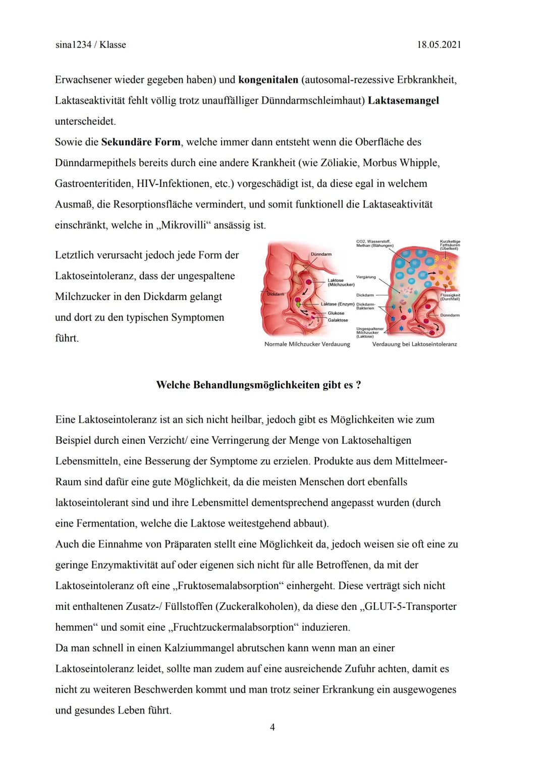 Klasse
Lactose
ОН
CH2OH
ОН
ОН
Klausurersatzleistung im
Fach Biologie
CH2OH
ОН
,,Laktoseintoleranz oder
doch etwas anderes?"
@sina1234
ОН
ОН
