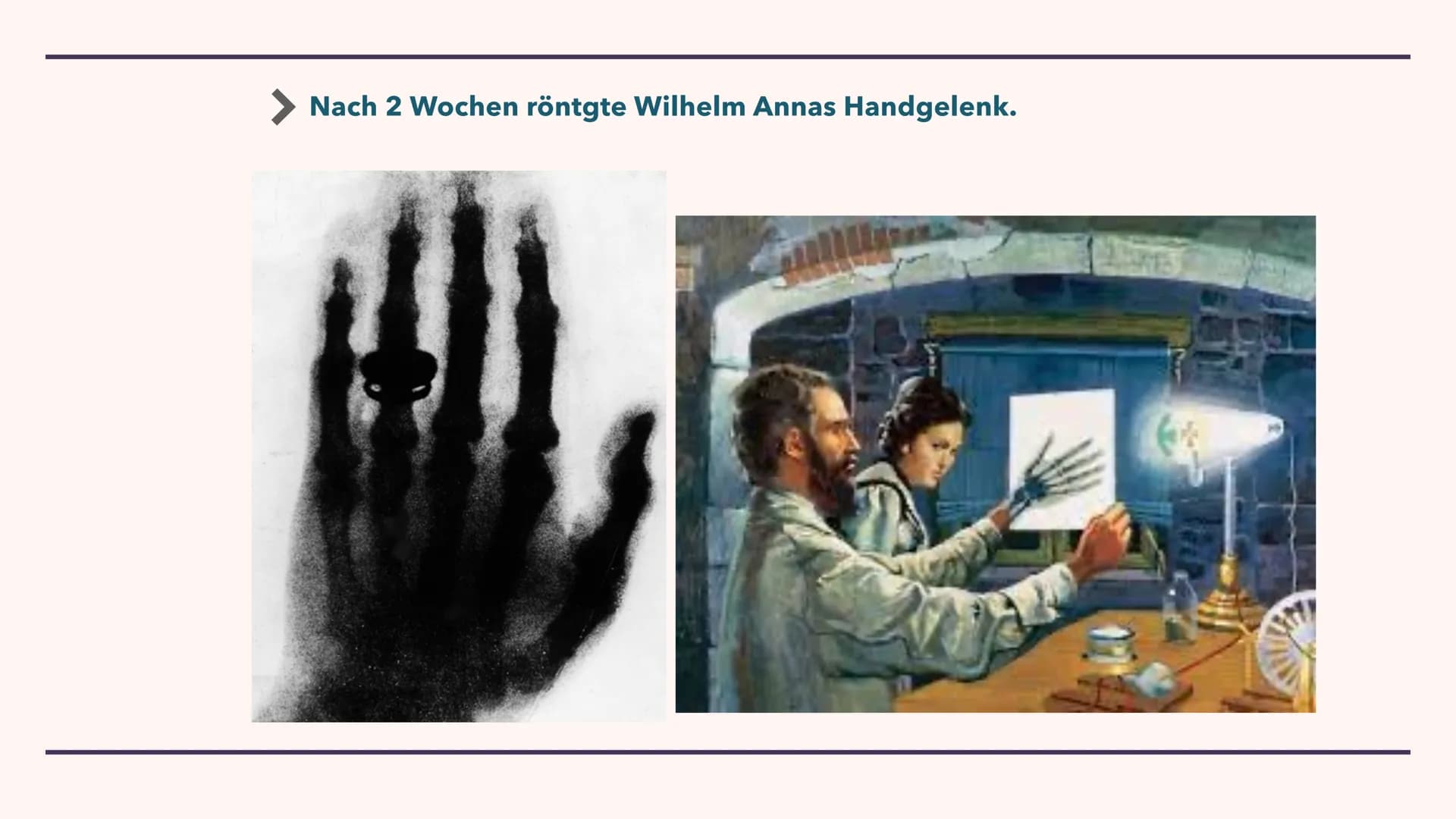 Wilhelm Conrad Röntgen's Entdeckung:
RÖNTGENSTRAHLUNG
Von Elma INHALTSVERZEICHNIS
Part 1 :
Wilhelms Biografie,seine Persönlichkeit und seine