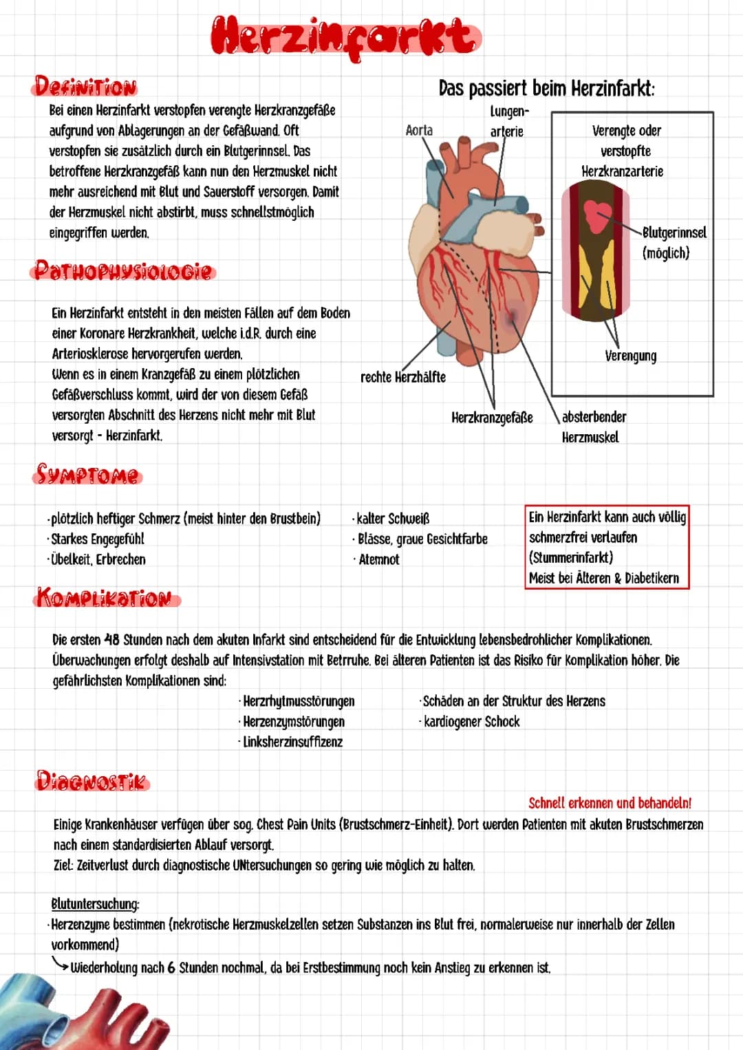 Herzinfarkt