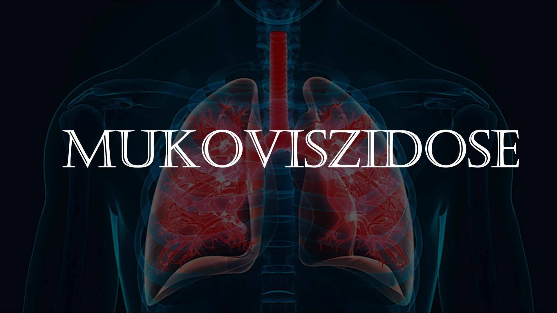 MUKOVISZIDOSE Gliederung

• Was ist Mukoviszidose ?
• Molekulargenetische
Ursachen
• Vererbung
• Häufigkeit/ Vorkommen
• Symptome
• Lebenser