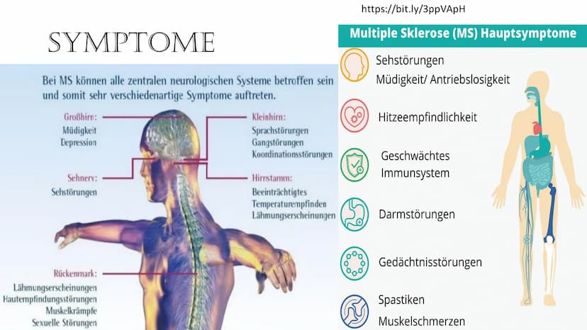 THE KRANKE
DIE KRANKHEIT DER
1000 GESICHTER
https://bit.ly/3AAltEQ
Von: Laura Bernhard
Sterose THEMEN
• Was ist Multiple Sklerose und wie hä