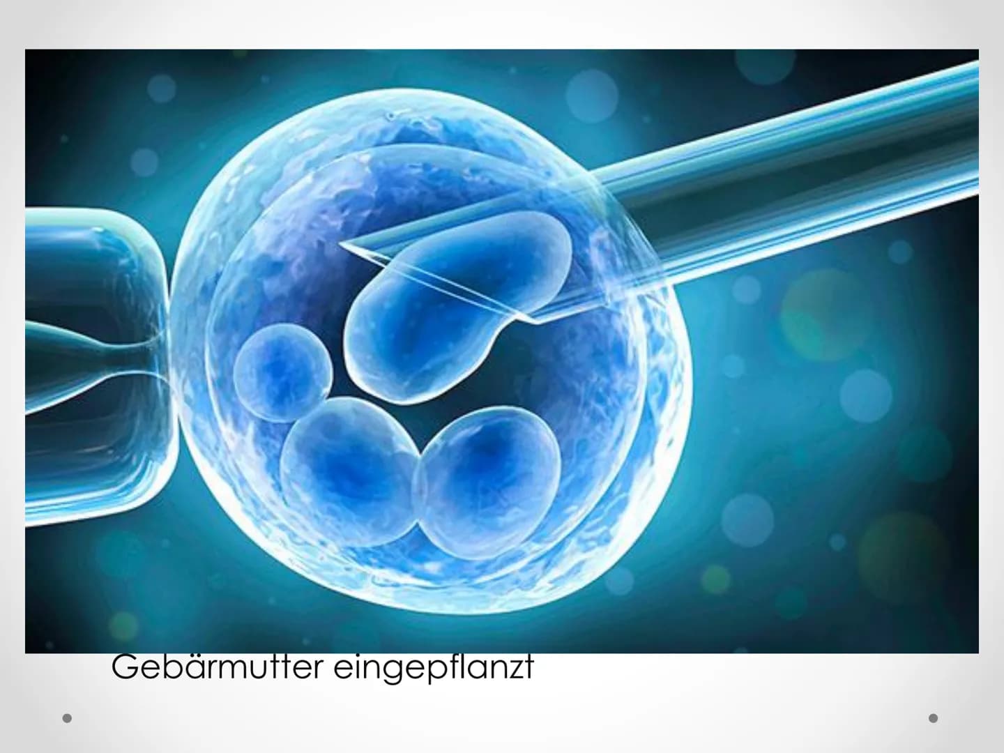 PID
Präimplantationsdiagnostik
GFS im Fach Biologie Gliederung
1. Allgemeines
2.
3. Verfahren
4. Ethische Aspekte
5. Rechtslage in Deutschla