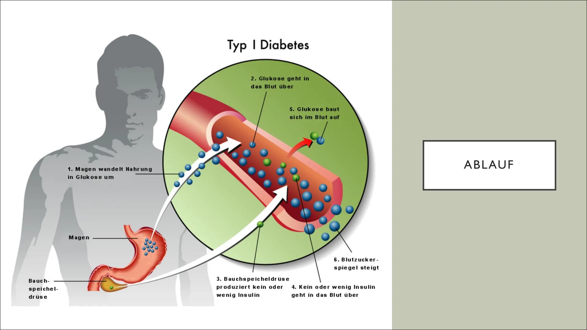 DIABETES MELLITUS
Von Fiona und Ceyda ●
Bedeutung und Geschichte
• Was ist Diabetes mellitus ?
Wie erkennt man, dass man Diabetes hat ?
Was 