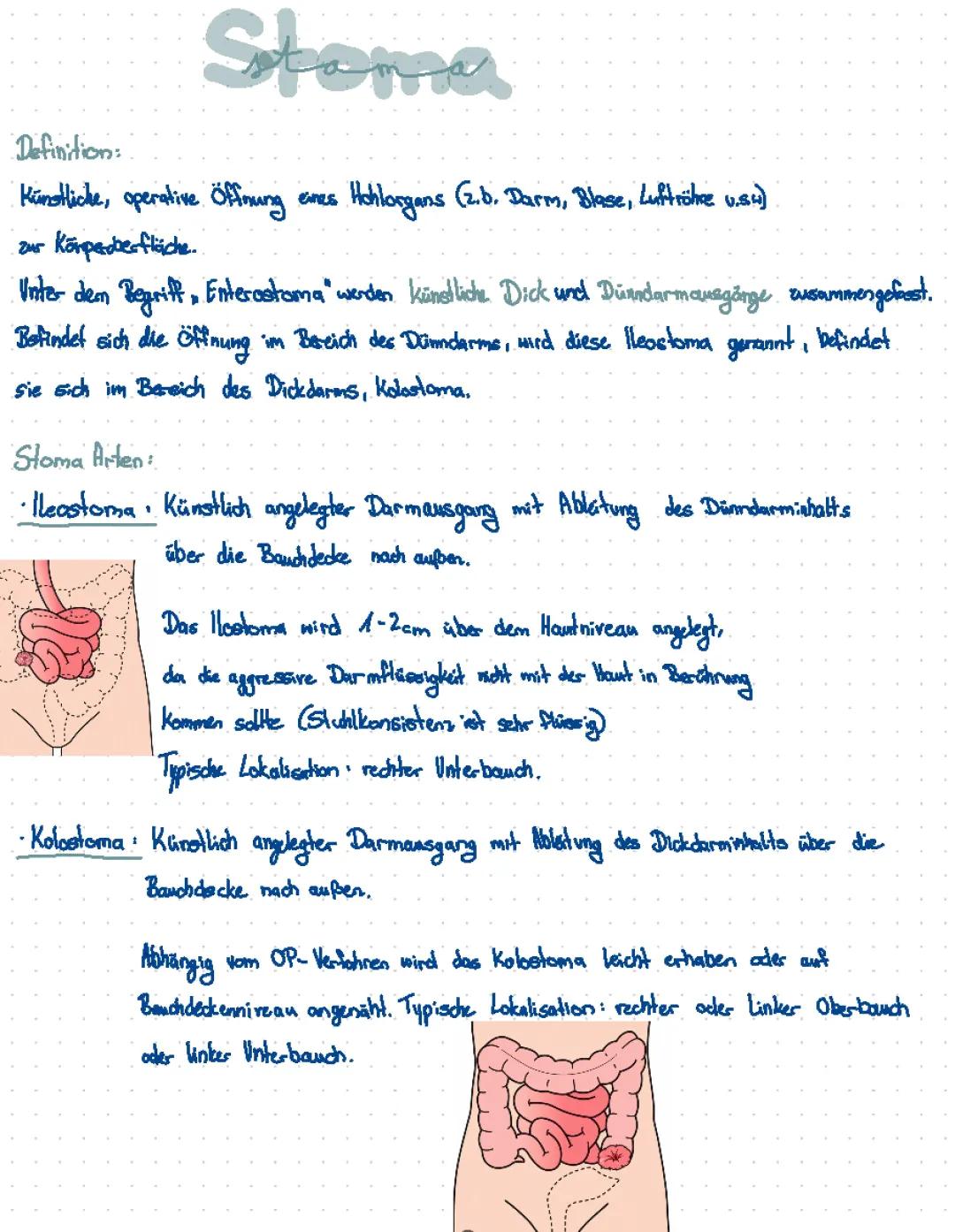 stoma