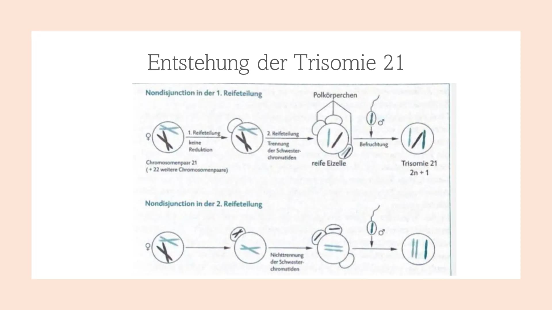 Trisomie 21
Down-Syndrom 1.
Allgemeines Trisomie 21
Wie entsteht Trisomie 21
3.
Formen von Trisomie 21
4. Entdeckung und Geschichte
5. Häufi