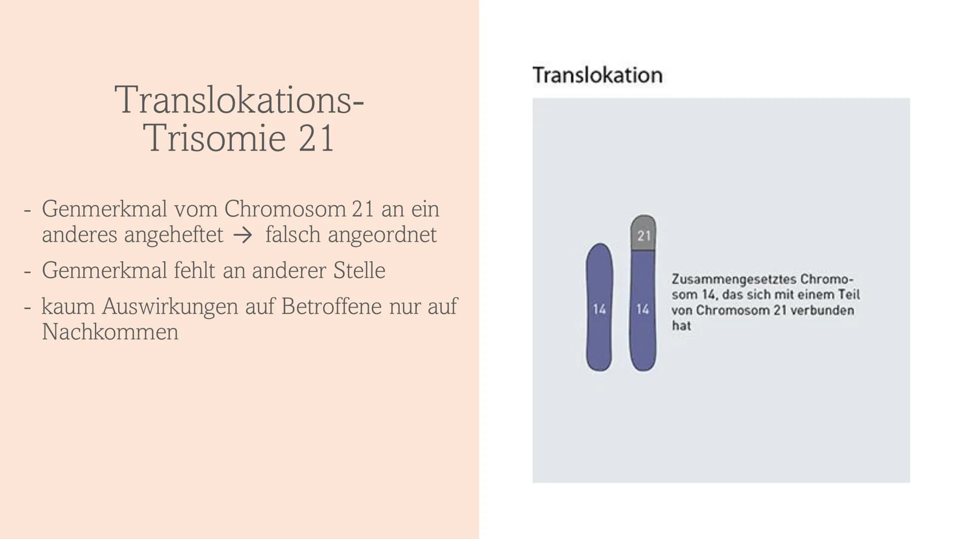 Trisomie 21
Down-Syndrom 1.
Allgemeines Trisomie 21
Wie entsteht Trisomie 21
3.
Formen von Trisomie 21
4. Entdeckung und Geschichte
5. Häufi