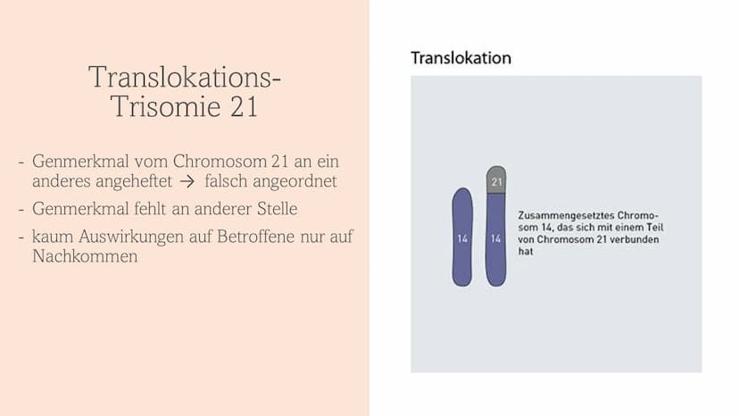 Trisomie 21
Down-Syndrom 1.
Allgemeines Trisomie 21
Wie entsteht Trisomie 21
3.
Formen von Trisomie 21
4. Entdeckung und Geschichte
5. Häufi