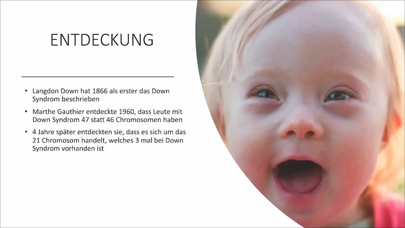 DOWN-SYNDROM
Trisomie 21 GLIEDERUNG
Was ist Trisomie 21?
Entdeckung
• Ursache und Risikofaktoren
Die drei unterschiedlichen Formen der Triso